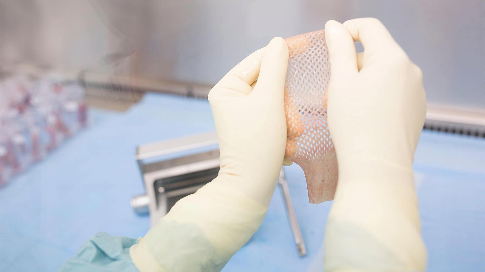 Skin graft being applied to a degloved facial wound