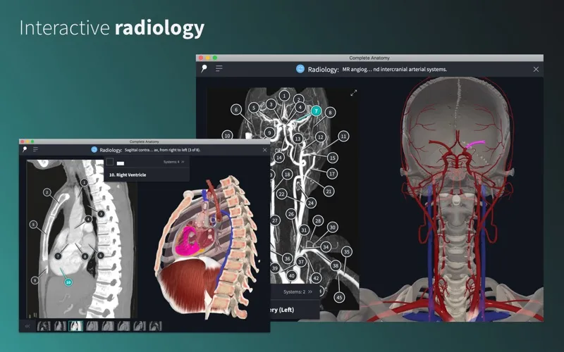 Verified anatomical diagram sourced ethically on iofbodies.com
